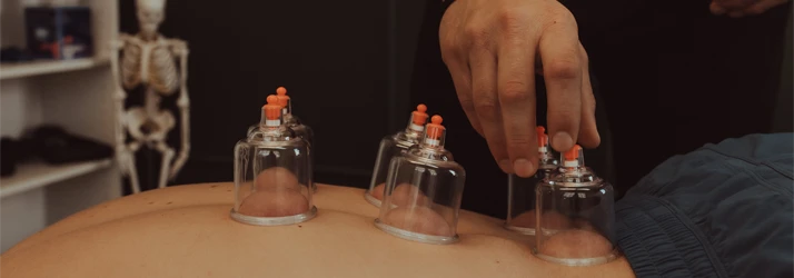Chiropractic Lincoln NE Dry Cupping Doctor preforming cupping therapy on a patients back