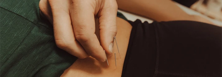 Chiropractic Lincoln NE Dry Needling Dr appling dry needles to the small of a patinets back
